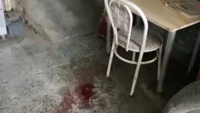 Sandalyeden Düşen Adamın Yaşadığı Korkunç Kaza Sağlığını Tehdit Ediyor