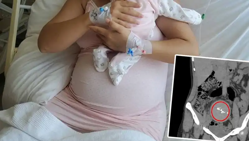 Bir Bebek Doğumdaki İhmallerle İki Yıl Sonra Ortaya Çıktı: Olay Şok Yarattı