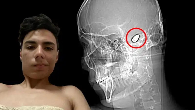 Zihinsel Sağlıkta Patlayan Sessizlik: Bomba Gibi Bir Yük Taşıyanlar