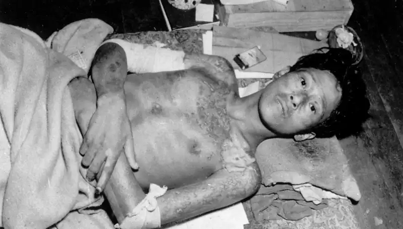80 Yıl Sonra Nagasaki'den Ürkütücü Uyarı: Nükleer Tehdit Yeniden Gündemde